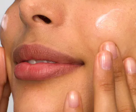 Nahaufnahme einer Wange mit großen Poren und Mitessern